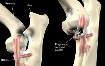 Abnormal Elbow