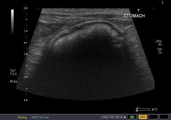 what will a dog ultrasound show